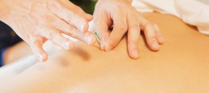 Seasonal Wellness: Harnessing the Power of Acupuncture in Winter